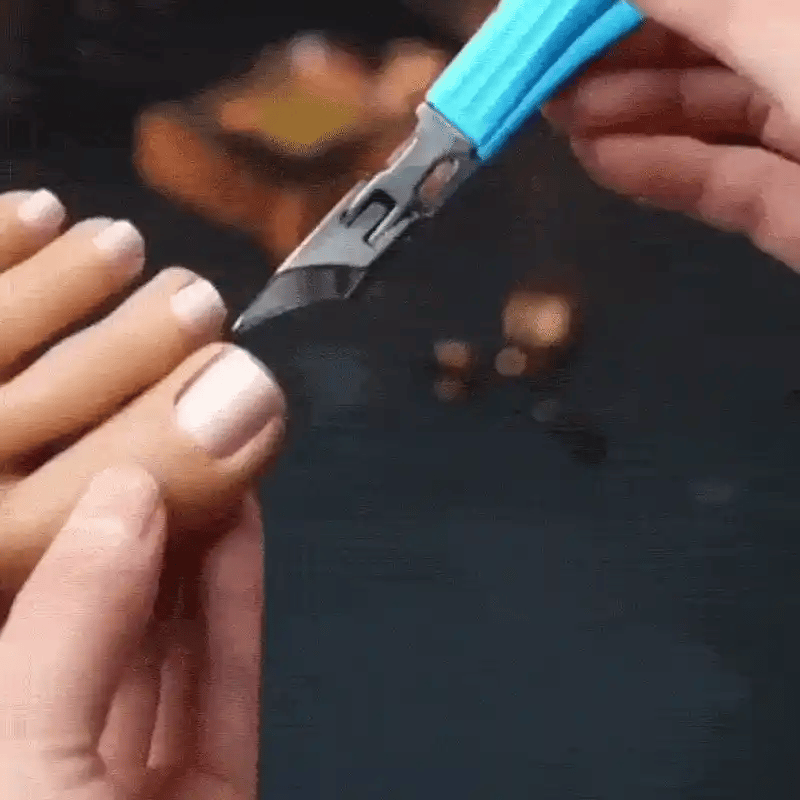 🦶 Ayuda a cuidar uñas encarnadas